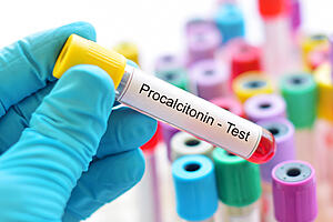 Sample tube with 'procalcitonin' label